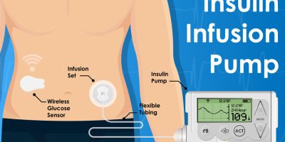 Insulin Infusion Pump Banner